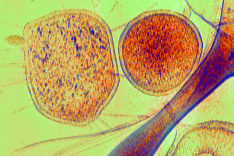 Photo of Archaea.