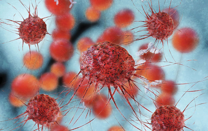 breast cancer cell