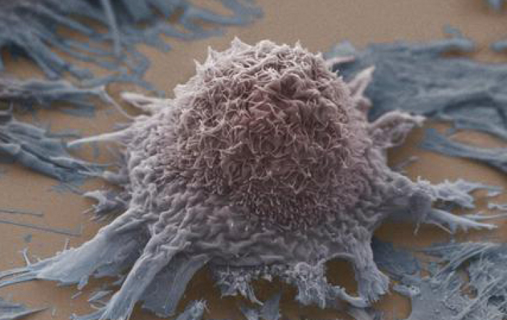 pinkish ball formed of strands, on top of spreading blue mats on a brown surface.