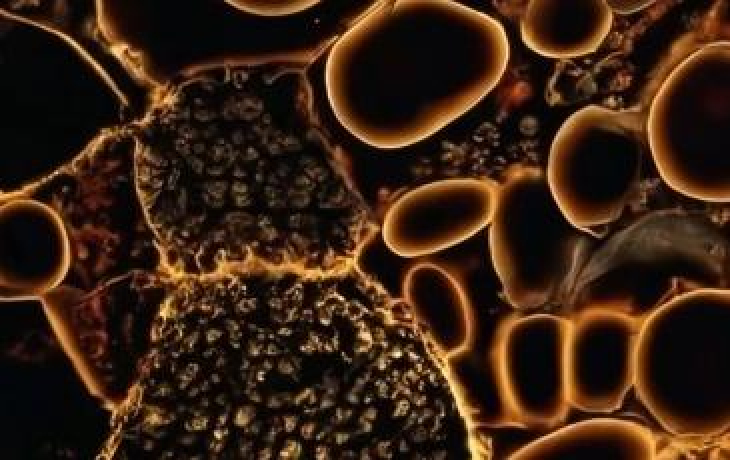 An abstract representation of microbes in soil as seen from under a microscope, generated by the DALL-E text-to-image model.