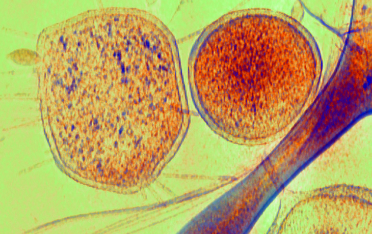 Photo of Archaea. 