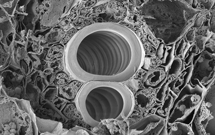 Microscopic image of plant cells.